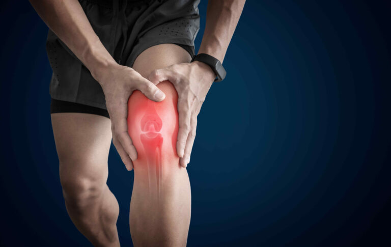 Knee Osteoarthritis