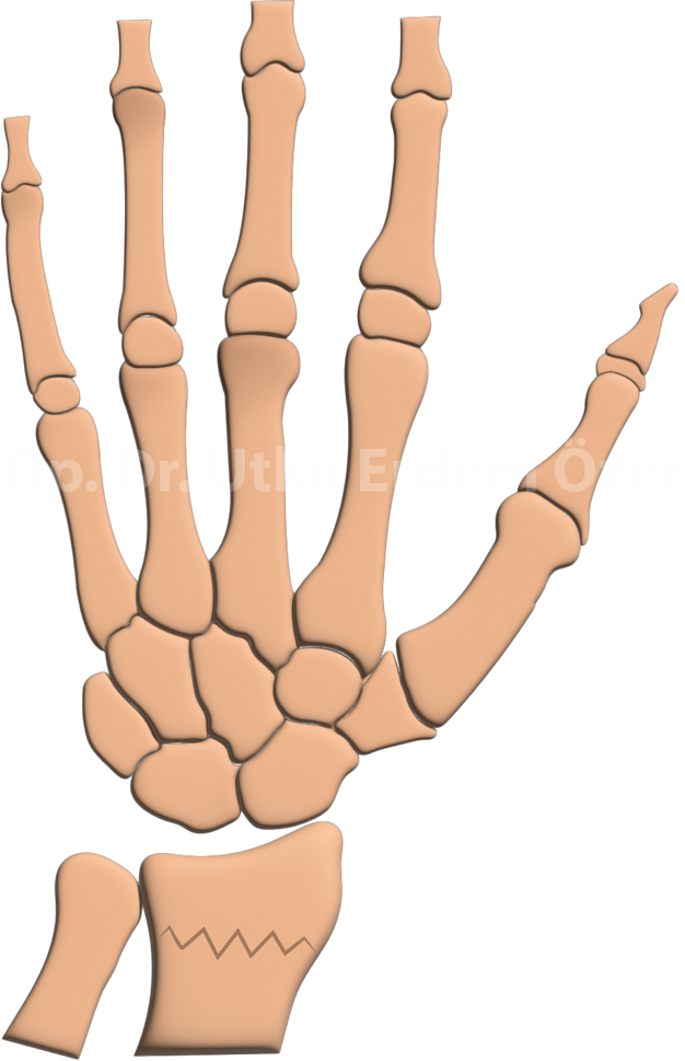 El Bileği Kırığı