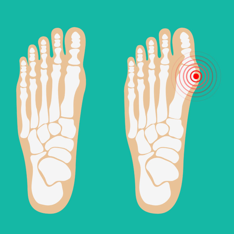 Sesamoid Kemik