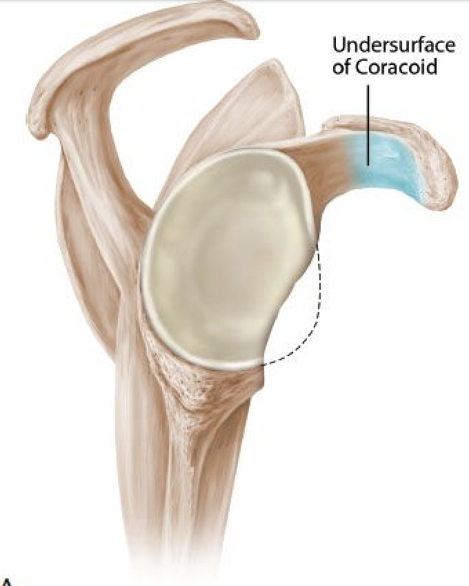 Kemik Kaybının Olduğu Omuz Çıkığı Ameliyatı: Glenoid Augmentasyon İşlemi