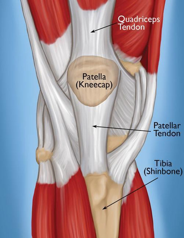 Kuadriseps Tendon Yırtığı ve Ameliyatı