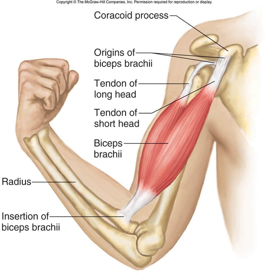 Distal Biceps Tear