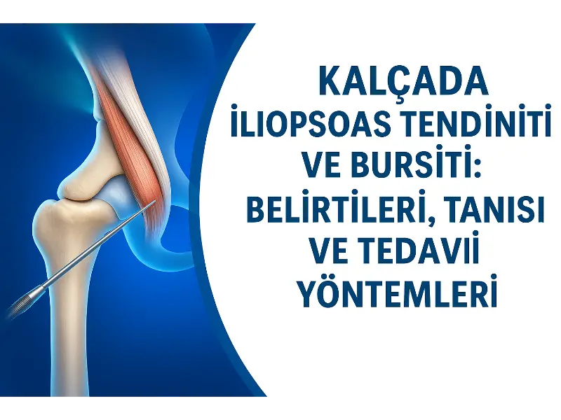 kalcada-iliopsoas-tendiniti-ve-bursiti-belirtileri-tanisi-ve-tedavi-yontemleri